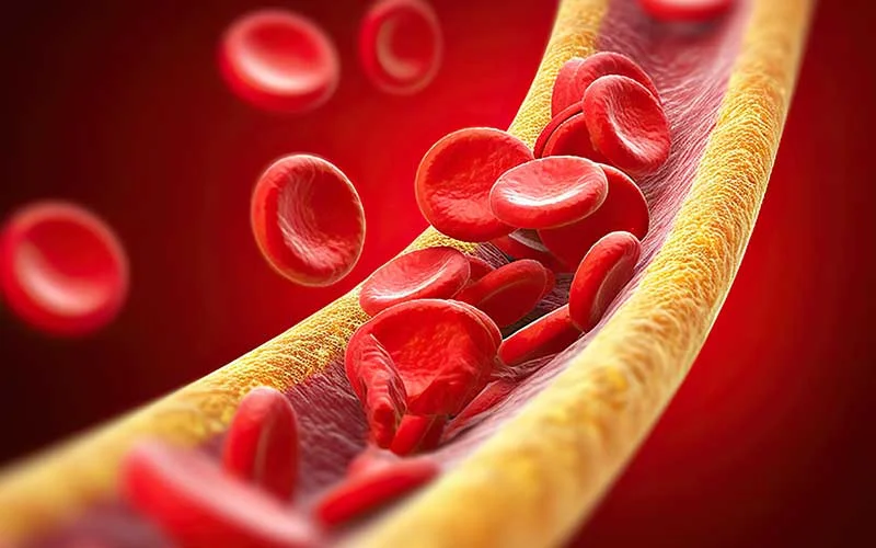 Blood cells and blood vessels with cholesterol.